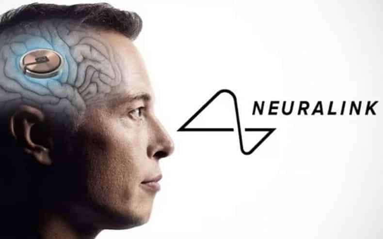 Neuralink